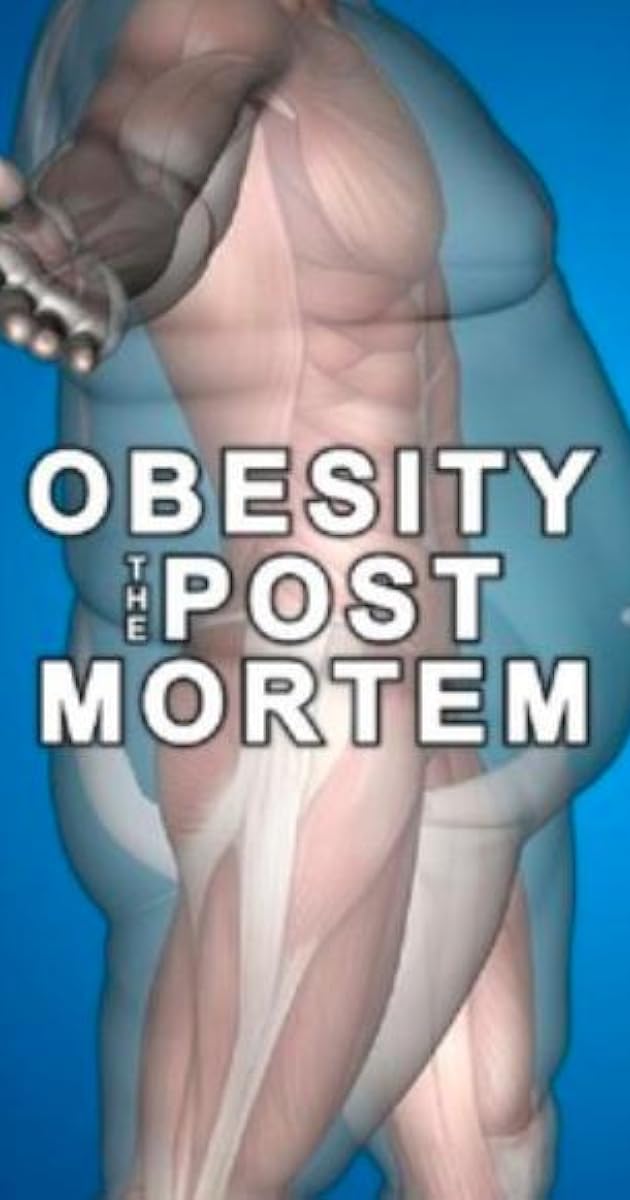 Obesity: The Post Mortem